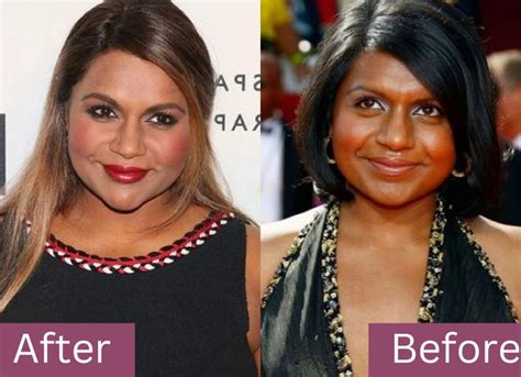 Mindy Kaling’s Transformative Journey: Plastic Surgery ...